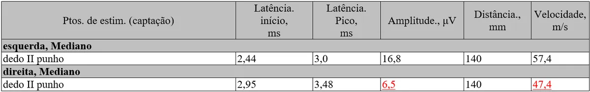 Tabela com latência, amplitude, distância e velocidade do nervo mediano direito e esquerdo na eletroneuromiografia, destacando velocidade de 47,4 m/s e amplitude de 6,5 µV no lado direito.